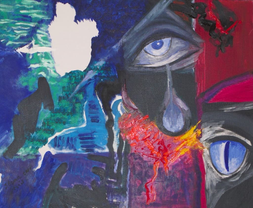 La douleur